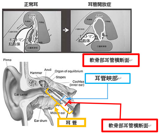 耳管の病気を理解するための予備知識